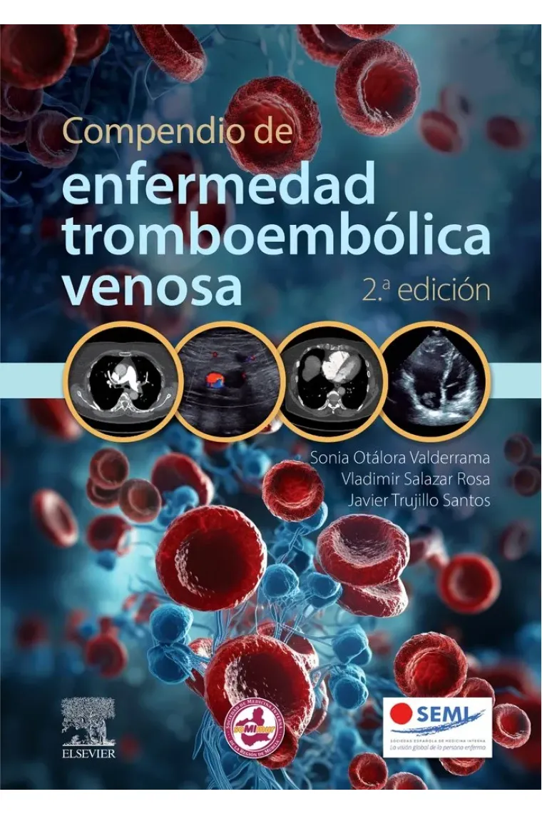 COMPENDIO DE ENFERMEDAD TROMBOEMBOLICA VENOSA 2ª ED