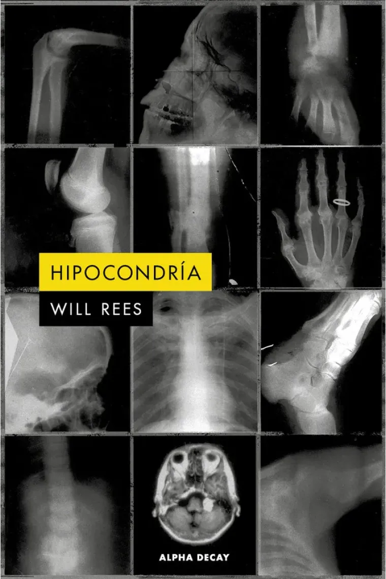 Hipocondría