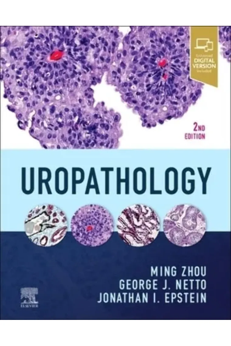 Uropathology