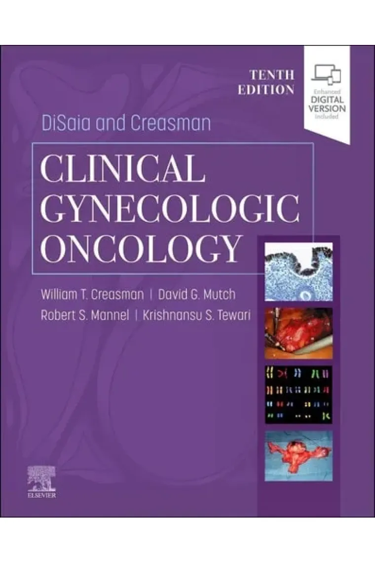 DiSaia and Creasman Clinical Gynecologic Oncology