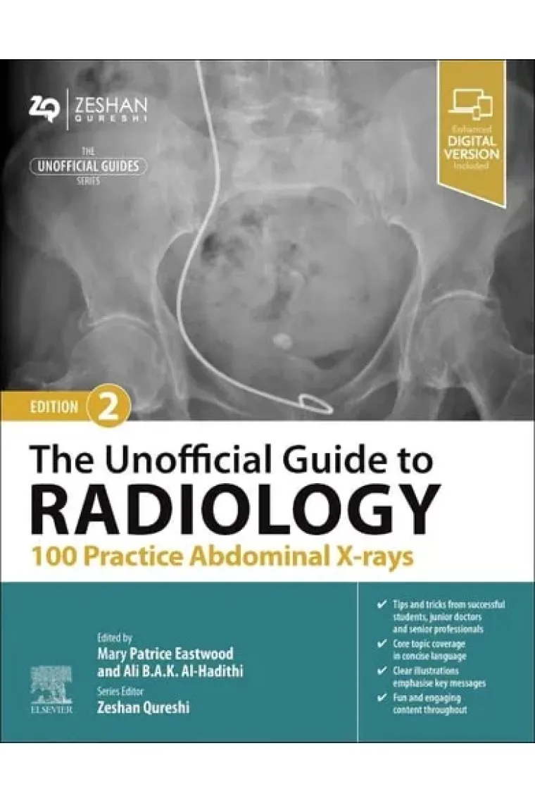 The Unofficial Guide to Radiology: 100 Practice Abdominal X-Rays