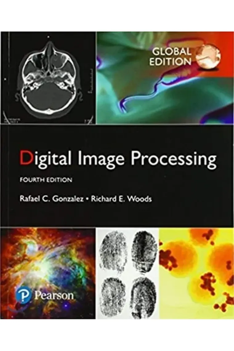 Digital Image Processing